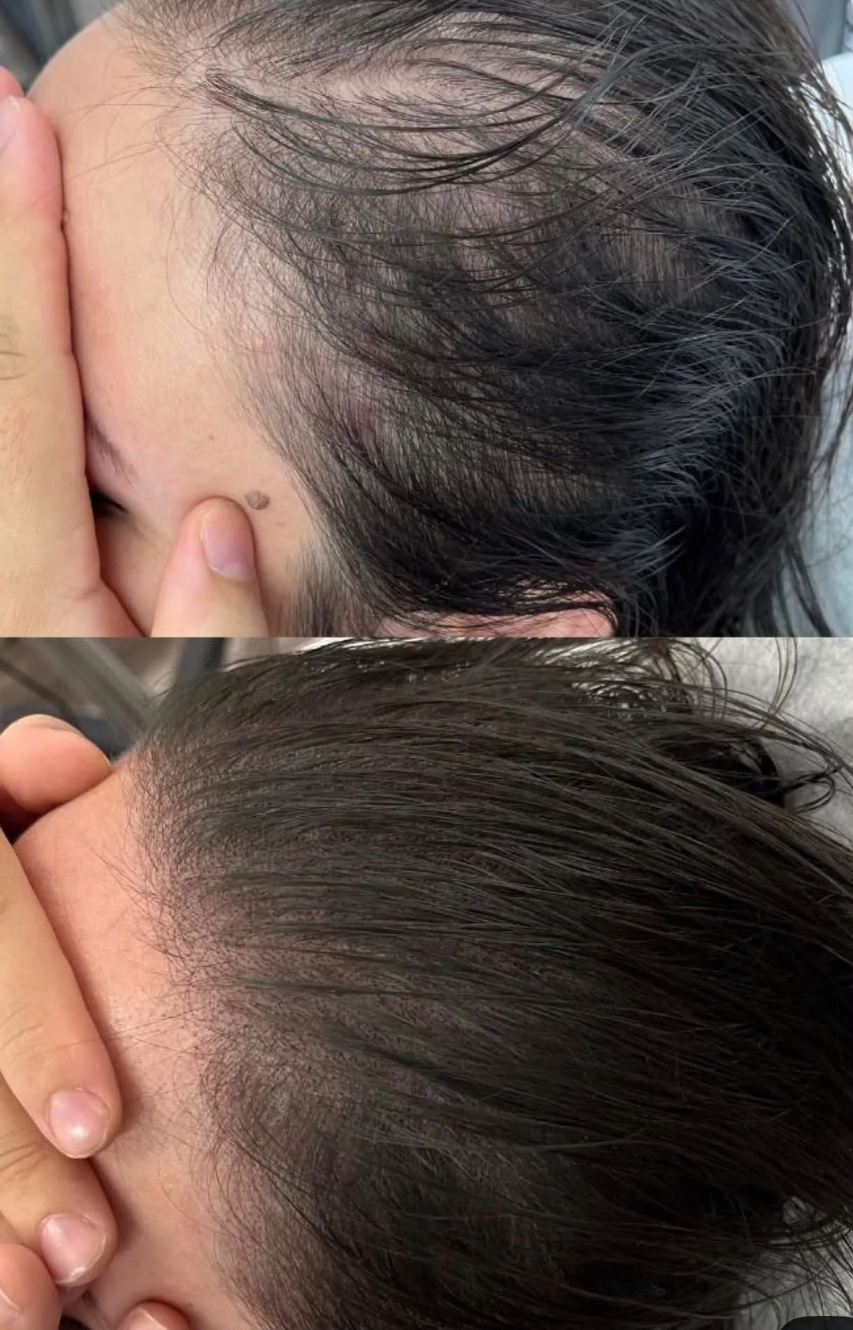 Resultado visual de cabello